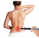 Elektronisk Akupunkturpenn - Massager Pen W-912 thumbnail